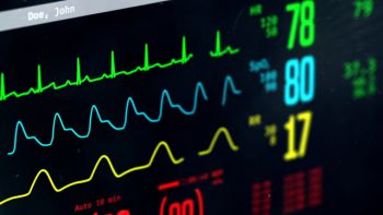 Do PA Catheters Lower Mortality in Cardiogenic Shock?